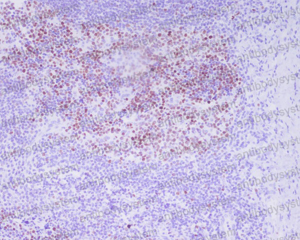 Валидация AntibodySystem RHF76501