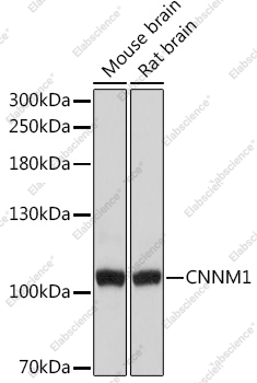 Вестерн-блоттинг, CNNM1, различные клеточные линии