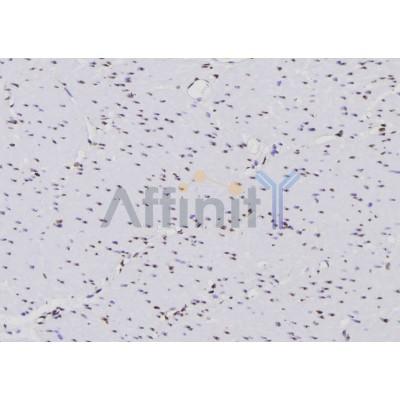 Валидация Affinity DF6414 - 17782