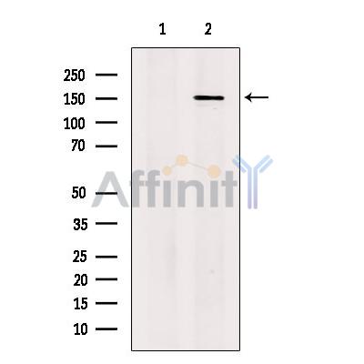 Валидация Affinity DF13456 - 8795
