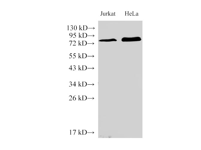 Вестерн-блоттинг, IL6R, клетки Jurkat и HeLa