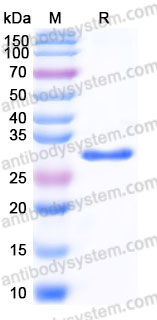 AHD27101, SDS-PAGE
