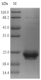 SDS-PAGE