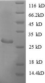 SDS-PAGE