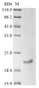 SDS-PAGE