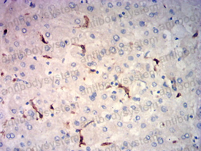 Валидация AntibodySystem RHC42003 (1020)