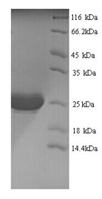 SDS-PAGE