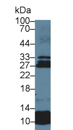 9851