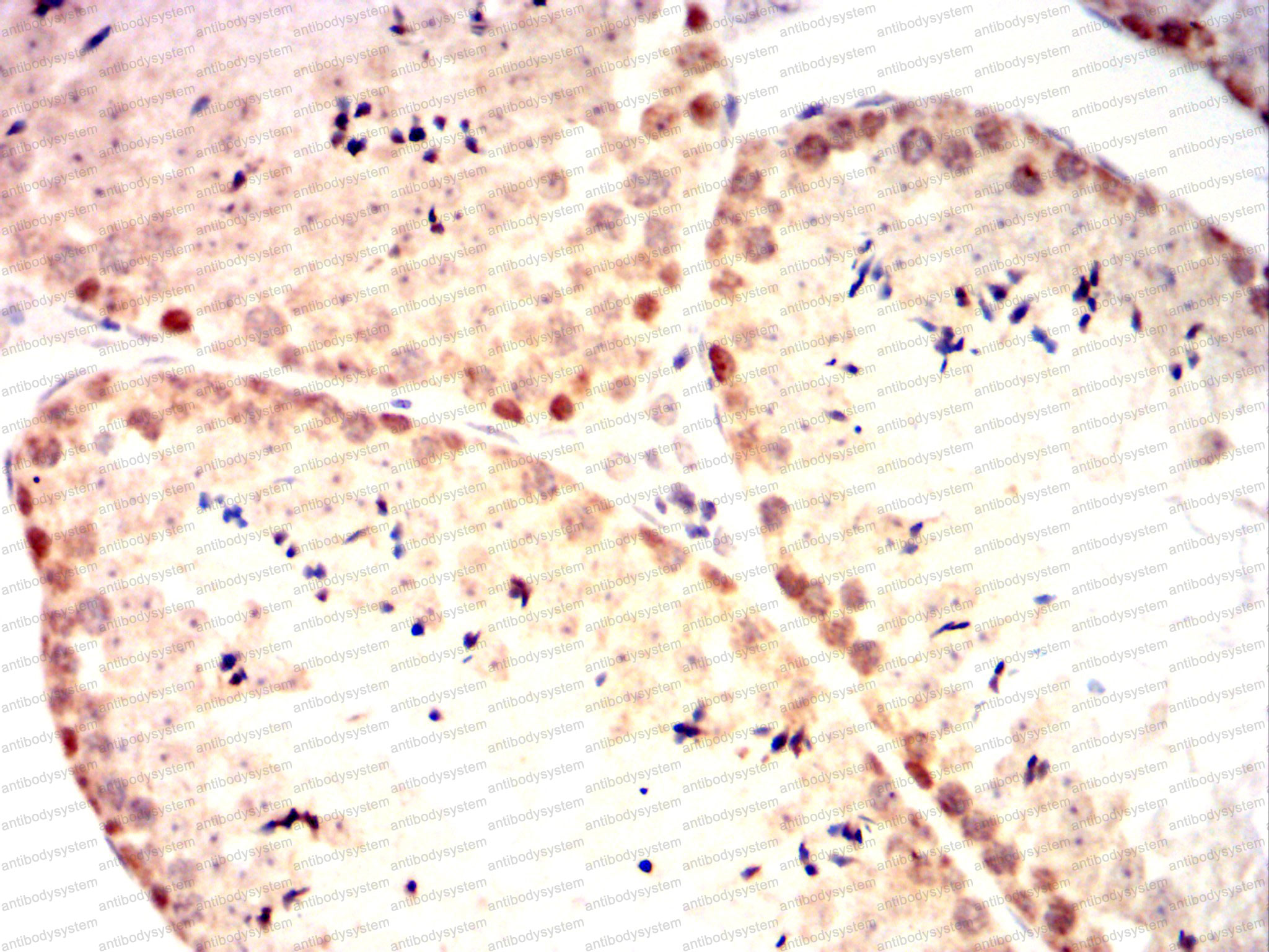 Валидация AntibodySystem RHG90002 (3111)