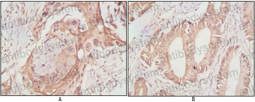 Валидация AntibodySystem RHJ64802