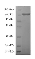 SDS-PAGE