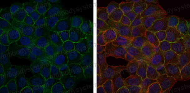 Валидация IF - AntibodySystem RHJ29702