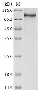 SDS-PAGE