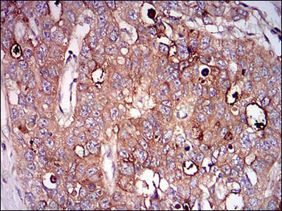 Валидация AntibodySystem RHD46601 (1589)