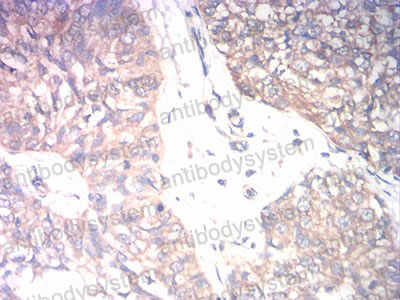 Валидация AntibodySystem RHE01501