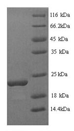 SDS-PAGE