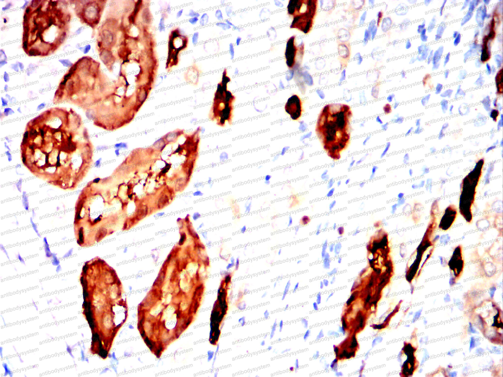 Валидация AntibodySystem RHJ73202 (3537)