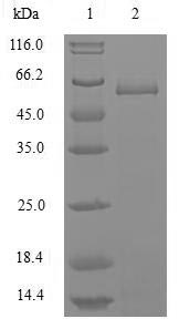 SDS-PAGE