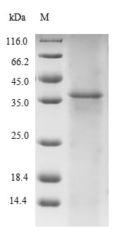 SDS-PAGE