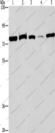 Вестерн-блоттинг, ACVR2A, клетки 293T, ткань мозга плода человека, клетки K562, ткань печени плода человека, клетки HeLa