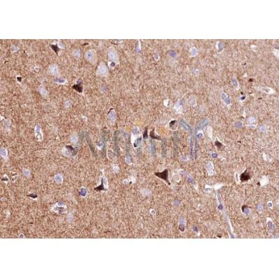 Валидация Affinity AF5178 - 2604