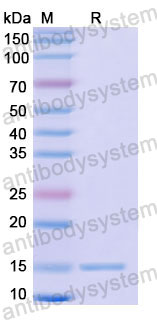 Валидация SDS-PAGE - AntibodySystem RHD64801