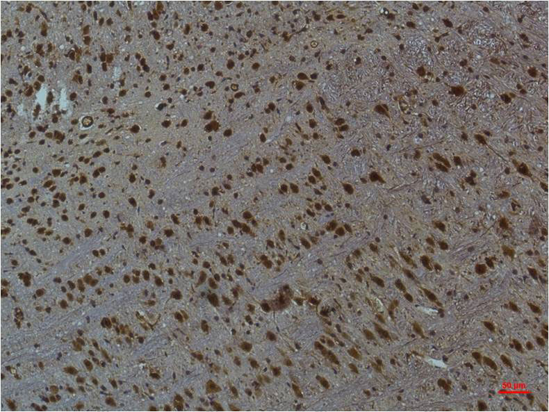 Валидация AntibodySystem RHG58303