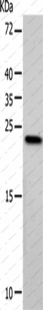 Вестерн-блоттинг, VSNL1, клетки HeLa