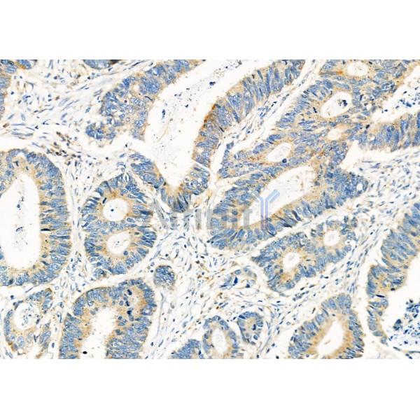 Валидация Affinity DF12307 - 6687