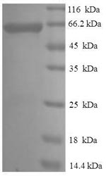 SDS-PAGE