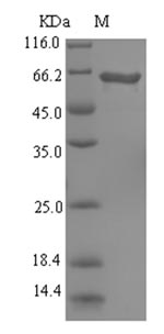 SDS-PAGE
