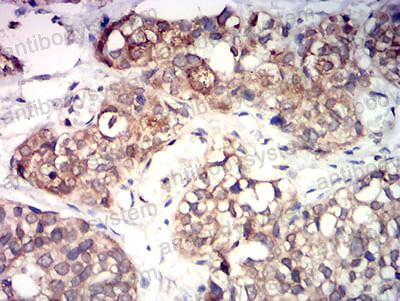 Валидация AntibodySystem RHK39202