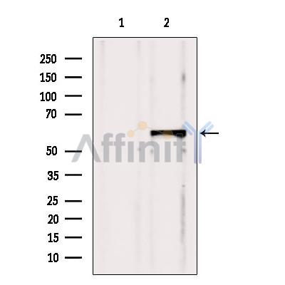Валидация Affinity DF6410 - 17775