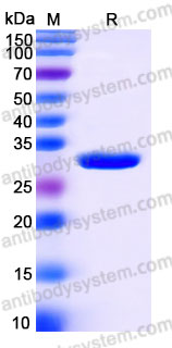 YHG52201, SDS-PAGE