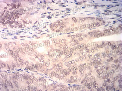 Валидация AntibodySystem RHN97702 (4020)