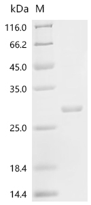 SDS-PAGE