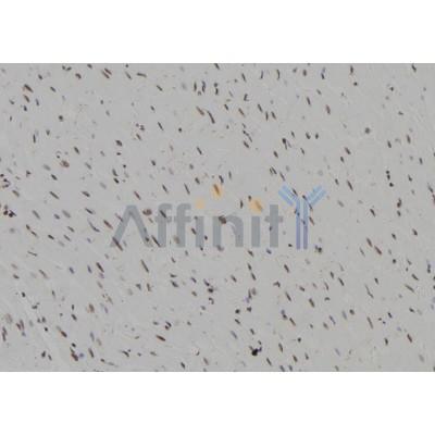 Валидация Affinity DF2464 - 13097