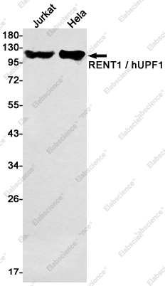 Вестерн-блоттинг, RENT1/hUPF1, клетки Jurkat и HeLa