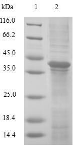 SDS-PAGE