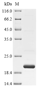 SDS-PAGE