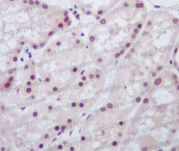 Валидация AntibodySystem RHG97301