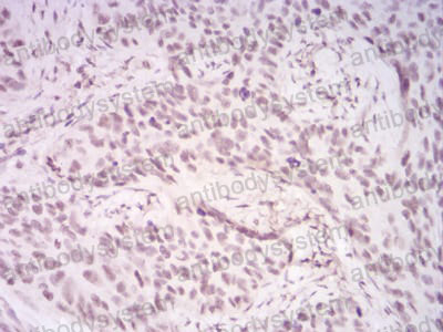 Валидация AntibodySystem RHG65801