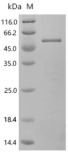 SDS-PAGE