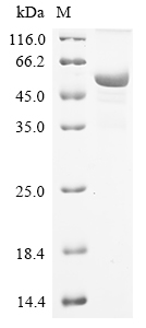 SDS-PAGE