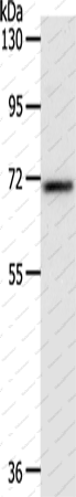 Вестерн-блоттинг, SOX-13, ткань печени мыши