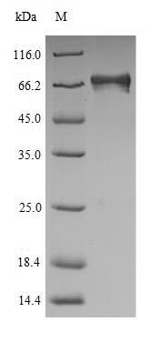 SDS-PAGE