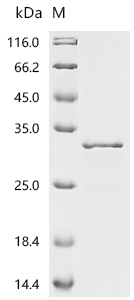 SDS-PAGE