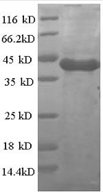 SDS-PAGE