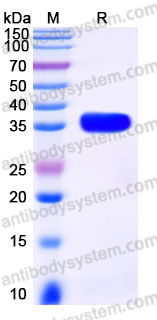 EHJ51401, SDS-PAGE