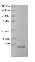 SDS-PAGE
